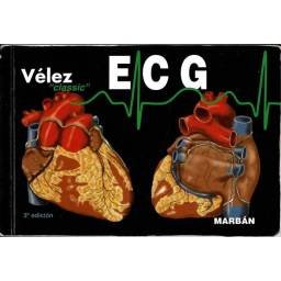 ECG: Pautas de...