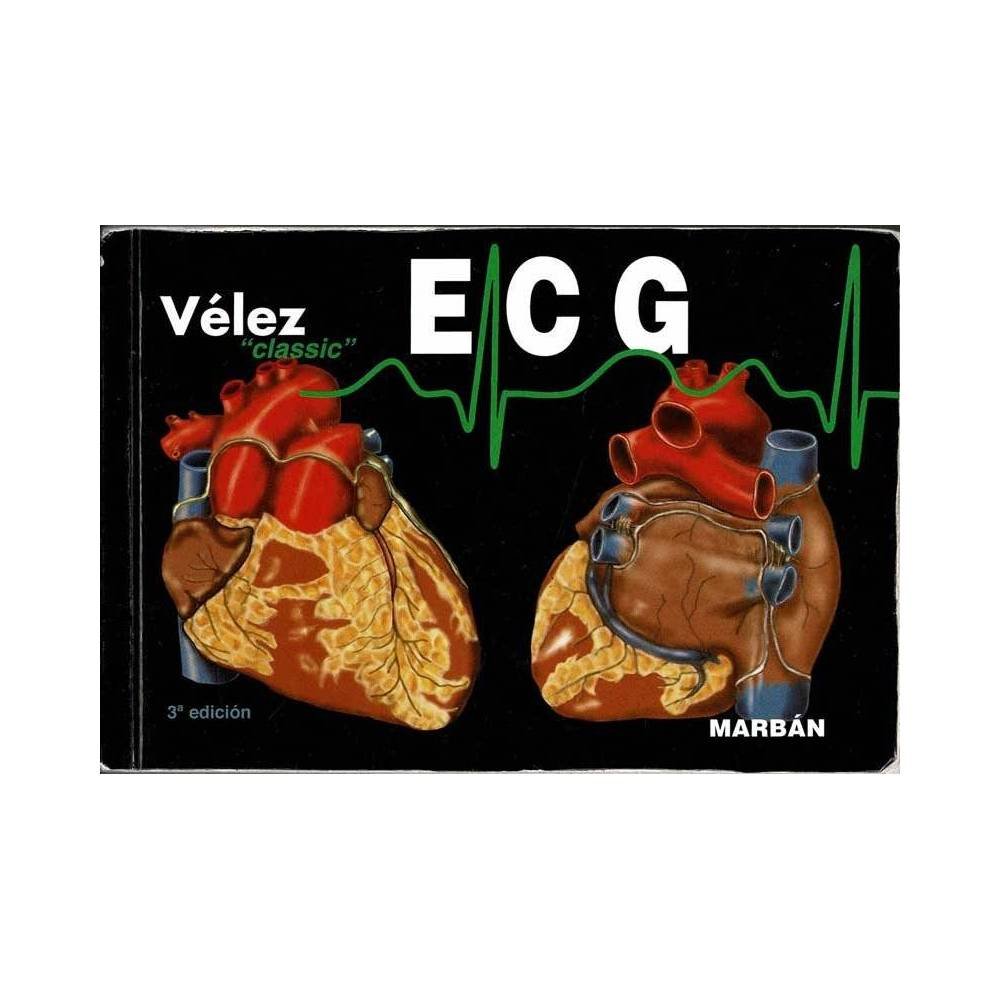 ECG: Pautas de electrocardiografía Vélez - Desirée Vélez Rodríguez