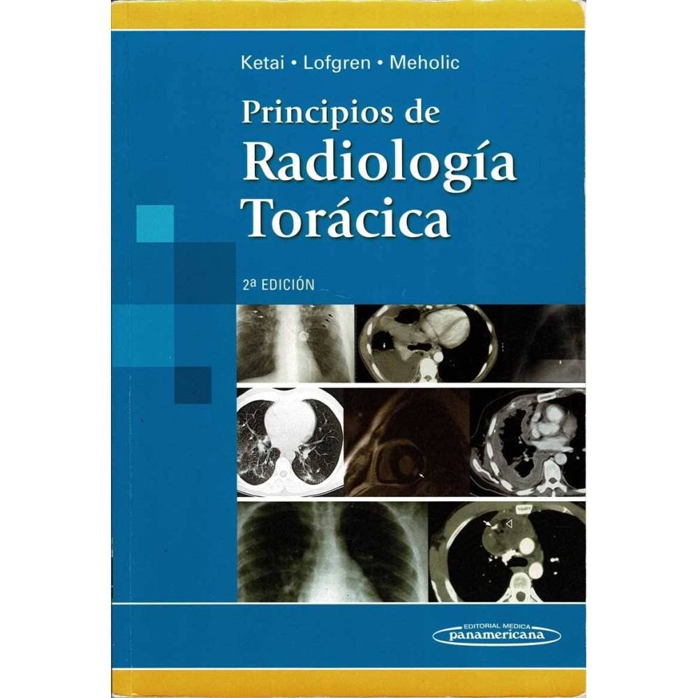 Principios de Radiología Torácica - Ketai, Lofgren, Meholic